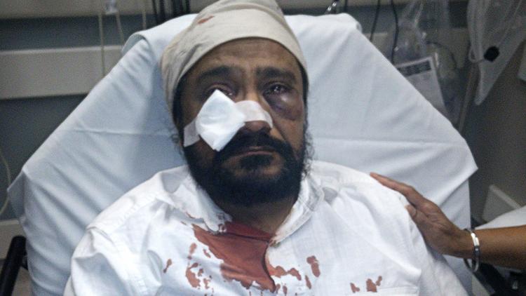 Inderjit Mukker was hospitalized after being punched in the face by an assailant who allegedly yelled, “Terrorist! ... Go back to your country.” (Sikh Coalition)